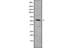 Western blot analysis of PDCD7 using K562 whole cell lysates (PDCD7 antibody  (C-Term))