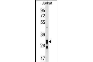 ACER1 Antibody (C-term) (ABIN1536908 and ABIN2850111) western blot analysis in Jurkat cell line lysates (35 μg/lane). (ACER1 antibody  (C-Term))