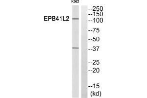 Western Blotting (WB) image for anti-erythrocyte Membrane Protein Band 4.1-Like 2 (EPB41L2) (Internal Region) antibody (ABIN1850880) (EPB41L2 antibody  (Internal Region))