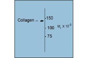 Image no. 1 for anti-Collagen, Type I (COL1) antibody (ABIN372600) (Collagen Type I antibody)