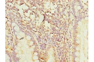Immunohistochemistry of paraffin-embedded human small intestine tissue using ABIN7150446 at dilution of 1:100 (POLR3A antibody  (AA 392-632))
