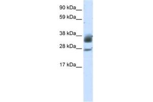 Western Blotting (WB) image for anti-Sirtuin 5 (SIRT5) antibody (ABIN2462029) (SIRT5 antibody)