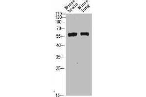 Western Blot analysis of mouse-brain mouse-lung cells using Beclin-1 Polyclonal Antibody diluted at 1:500. (Beclin 1 antibody  (AA 110-190))