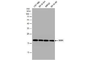 WB Image SOD1 antibody detects SOD1 protein by western blot analysis. (SOD1 antibody)
