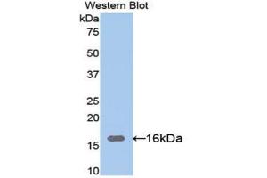 Western blot analysis of the recombinant protein. (LGALS9C antibody  (AA 228-356))