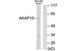 Western blot analysis of extracts from mouse brain cells, using AKAP10 Antibody. (AKAP10 antibody  (AA 10-59))