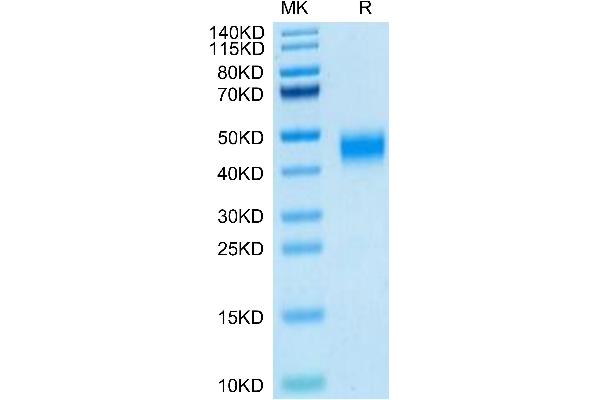 MXRA8 Protein (AA 20-341) (His tag)