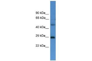 WB Suggested Anti-SPR  Antibody Titration: 0. (SPR antibody  (C-Term))