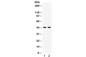 Western blot testing of 1) rat kidney and 2) human placenta lysate with HSD11B2 antibody. (HSD11B2 antibody)