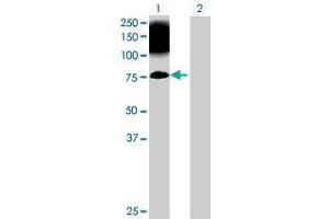 Western Blotting (WB) image for STXBP1 293T Cell Transient Overexpression Lysate(Denatured) (ABIN1333617)