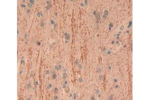 Used in DAB staining on fromalin fixed paraffin- embedded brain tissue (CADPS antibody  (AA 1186-1352))