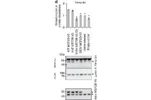 Western Blotting (WB) image for anti-Vimentin (VIM) antibody (ABIN2854814)