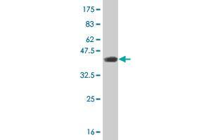 Western Blot detection against Immunogen (37. (Retinoic Acid Receptor alpha antibody  (AA 315-424))