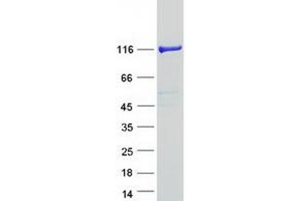 PHKB Protein (Transcript Variant 2) (Myc-DYKDDDDK Tag)