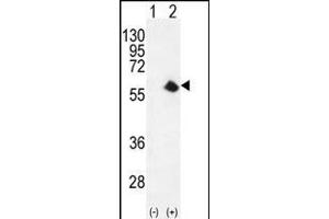 Western blot analysis of CDK8 (arrow) using rabbit polyclonal CDK8 Antibody (Center) (ABIN655911 and ABIN2845310). (CDK8 antibody  (AA 249-277))