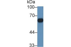 Western blot analysis of Mouse Adrenal gland lysate, using Rat CYP11B1 Antibody (1 µg/ml) and HRP-conjugated Goat Anti-Rabbit antibody ( (CYP11B1 antibody  (AA 1-498))