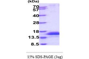 SDS-PAGE (SDS) image for Integrin beta 4 (ITGB4) (AA 28-710) protein (His tag) (ABIN6388181) (Integrin beta 4 Protein (ITGB4) (AA 28-710) (His tag))