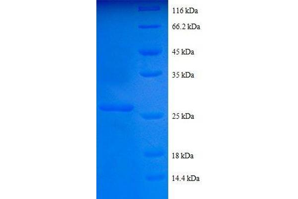 COL4a2 Protein (AA 1493-1712, partial) (His tag)