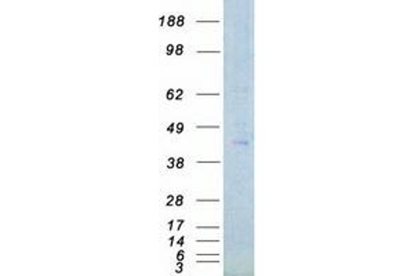 PHKG1 Protein (Myc-DYKDDDDK Tag)