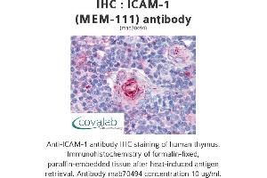 Image no. 1 for anti-Intercellular Adhesion Molecule 1 (ICAM1) antibody (ABIN1723360) (ICAM1 antibody)