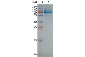 Human SC-Nanodisc, Flag Tag on SDS-PAGE (SCARB1 Protein)