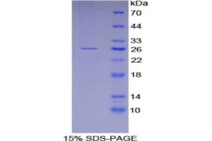 SDS-PAGE analysis of Mouse GSTa4 Protein. (GSTA4 Protein)