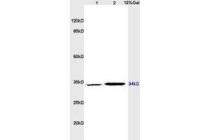 Lane 1: rat brain lysates Lane 2: rat heart lysates probed with Anti CD1A Polyclonal Antibody, Unconjugated (ABIN702700) at 1:200 in 4 °C. (CD1d1 antibody  (AA 51-150))