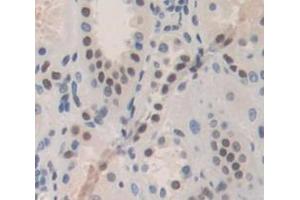 IHC-P analysis of Human Tissue, with DAB staining. (PRAME antibody  (AA 416-502))