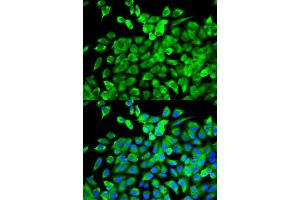 Immunofluorescence analysis of MCF-7 cells using EIF4A1 antibody. (EIF4A1 antibody)