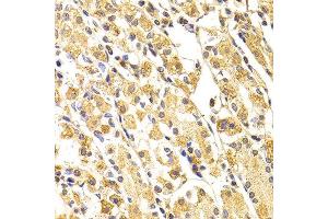 Immunohistochemistry of paraffin-embedded human stomach using CASP3 antibody at dilution of 1:100 (x400 lens). (Caspase 3 antibody)