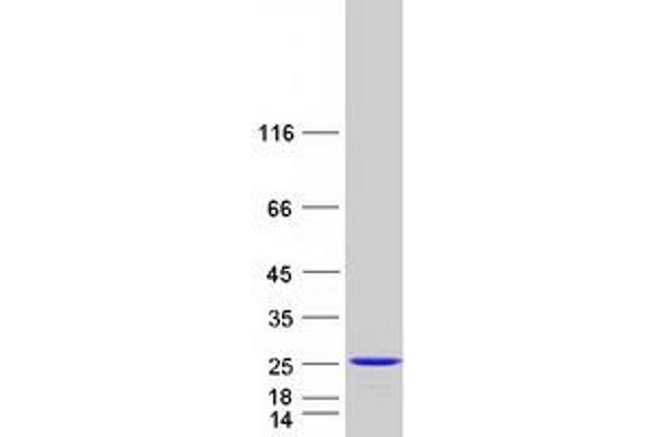 RAP2B Protein (Myc-DYKDDDDK Tag)