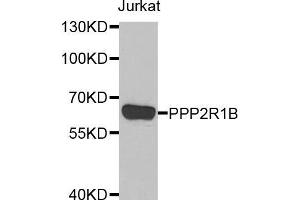 Western blot analysis of extracts of Jurkat cells, using PPP2R1B antibody (ABIN5974048) at 1/1000 dilution. (PPP2R1B antibody)