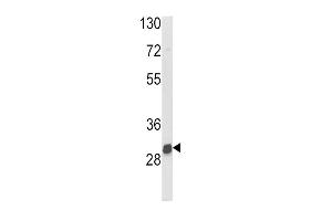 Western blot analysis of NAT2 Antibody in mouse kidney tissue lysates (35ug/lane) (NAT2 antibody  (C-Term))