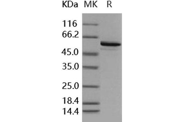 BMPR1B Protein (AA 149-502) (GST tag,His tag)