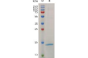 Mouse RN Protein, His Tag on SDS-PAGE under reducing condition. (RNASE4 Protein (AA 30-472) (His tag))