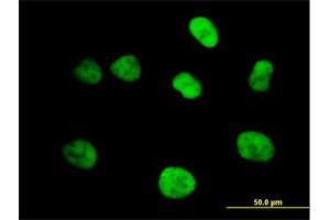 Immunofluorescence of purified MaxPab antibody to MCM4 on HeLa cell. (MCM4 antibody  (AA 1-863))