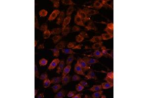 Immunofluorescence analysis of L929 cells using TENM1 antibody (ABIN7270767) at dilution of 1:100. (ODZ1/Teneurin 1 antibody  (AA 350-540))