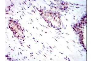 Immunohistochemistry (IHC) image for anti-Yes-Associated Protein 1 (YAP1) antibody (ABIN969574)