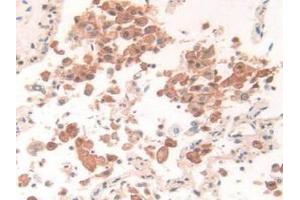 IHC-P analysis of Human Lung Tissue, with DAB staining. (IFI30 antibody  (AA 1-250))