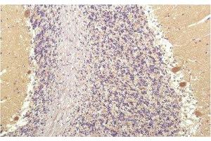 Immunohistochemistry of paraffin-embedded Human brain tissue using SGK1 Monoclonal Antibody at dilution of 1:200. (SGK1 antibody)