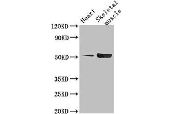 Tryptophan Hydroxylase 1 antibody  (AA 257-405)