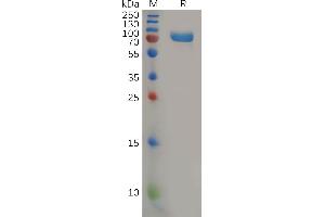 Human CD112 Protein, mFc Tag on SDS-PAGE under reducing condition. (PVRL2 Protein (AA 32-360) (mFc Tag))
