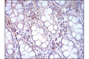 Immunohistochemistry (IHC) image for anti-CD14 (CD14) (AA 20-214) antibody (ABIN1724922)