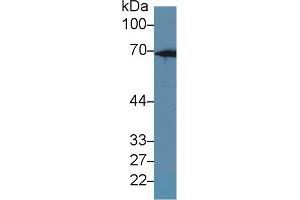 Western Blot; Sample: Rat Liver lysate; Primary Ab: 1µg/ml Rabbit Anti-Rat KRT2 Antibody Second Ab: 0. (Keratin 2 antibody  (AA 508-685))