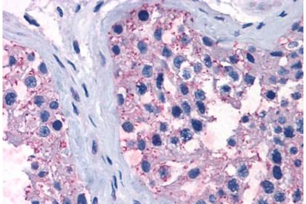 TAS1R1 antibody  (Cytoplasmic Domain)