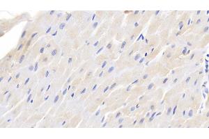 Detection of TGFb1 in Canine Cardiac Muscle Tissue using Polyclonal Antibody to Transforming Growth Factor Beta 1 (TGFb1) (TGFB1 antibody  (AA 279-390))