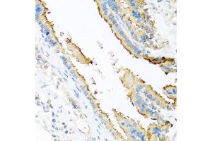 Immunohistochemistry of paraffin-embedded mouse lung using ApoE antibody at dilution of 1:100 (40x lens). (APOE antibody)