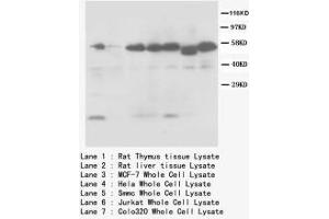Image no. 1 for anti-Caspase 8 (CASP8) (Internal Region) antibody (ABIN1490391) (Caspase 8 antibody  (Internal Region))