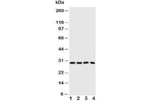 Western blot testing of Carbonic Anhydrase III antibody and Lane 1:  SMMC-7721;  2: HeLa;  3: SW620;  4: SCG cell lysate (CA3 antibody  (N-Term))