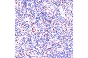 Immunohistochemistry of paraffin-embedded rat spleen using KDM1 antibody (ABIN7268323) at dilution of 1:100 (40x lens). (LSD1 antibody  (AA 130-380))